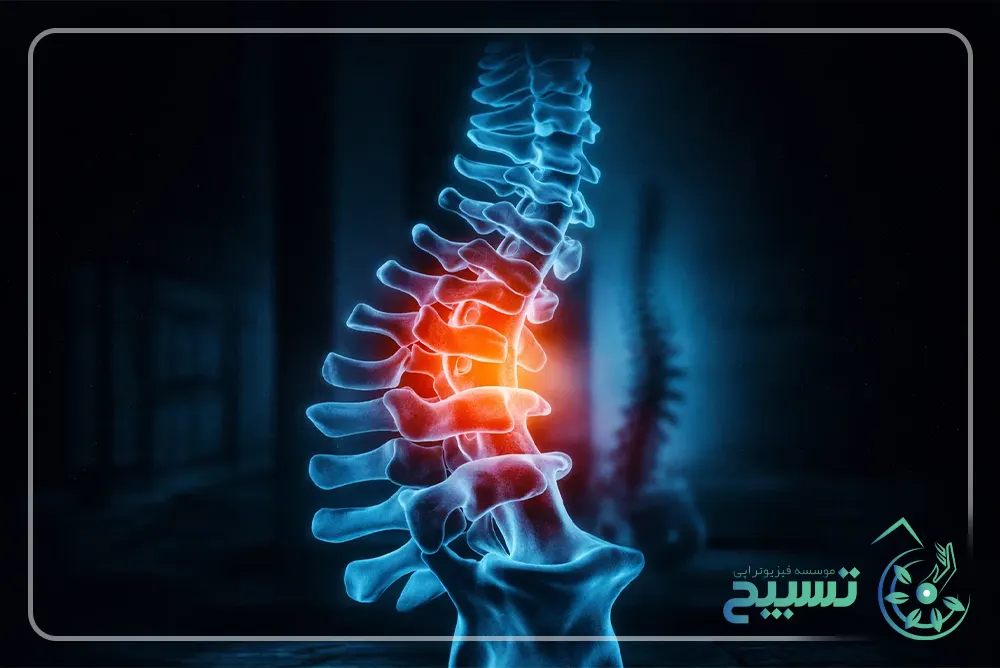 علت درد ستون فقرات