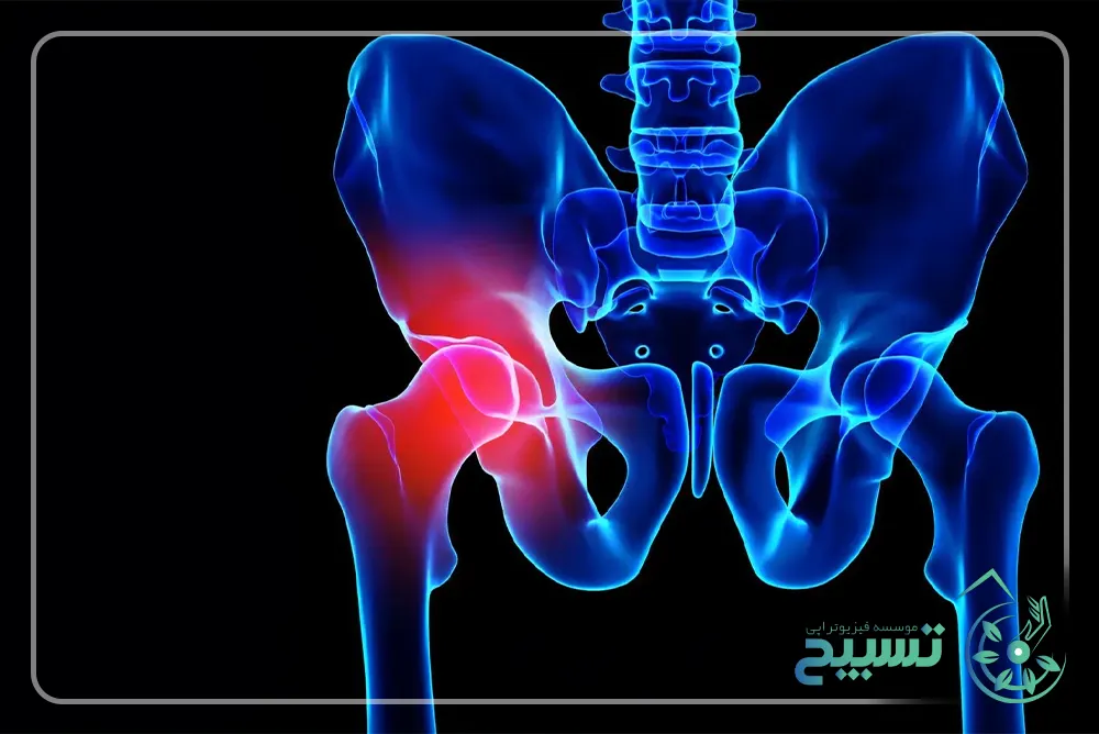 آناتومی لگن و باسن