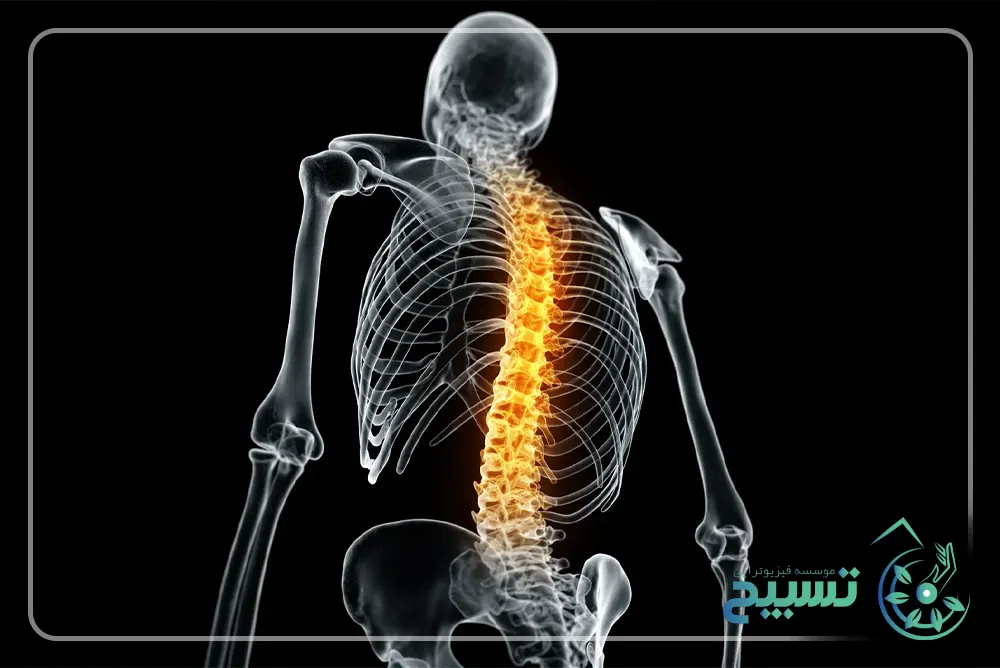 علائم خطرناک برای ستون فقرات