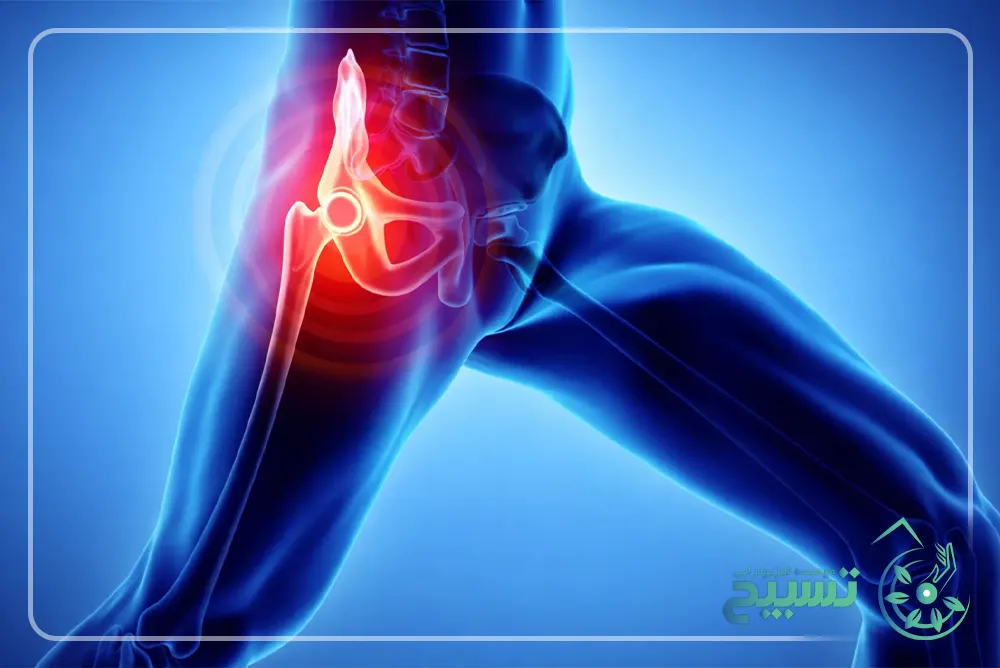 پیشگیری از درد لگن و باسن