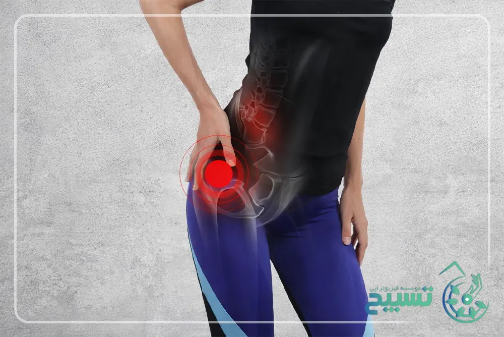 فیزیوتراپی لگن و باسن