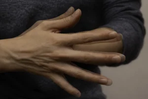 انواع بیماری‌های عصبی و نوروژنیک