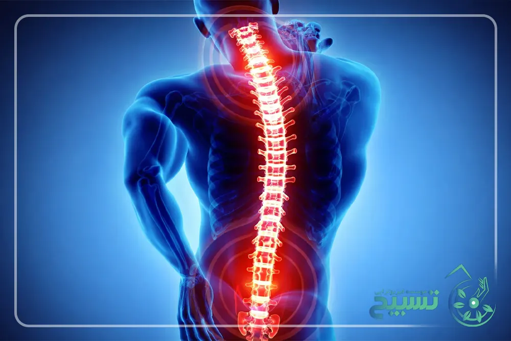 بیماریهای ستون فقرات