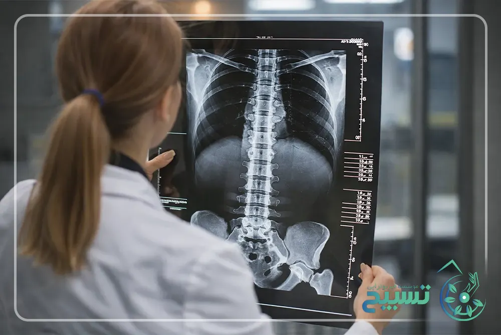 بیماریهای ناحیه پشتی ستون فقرات