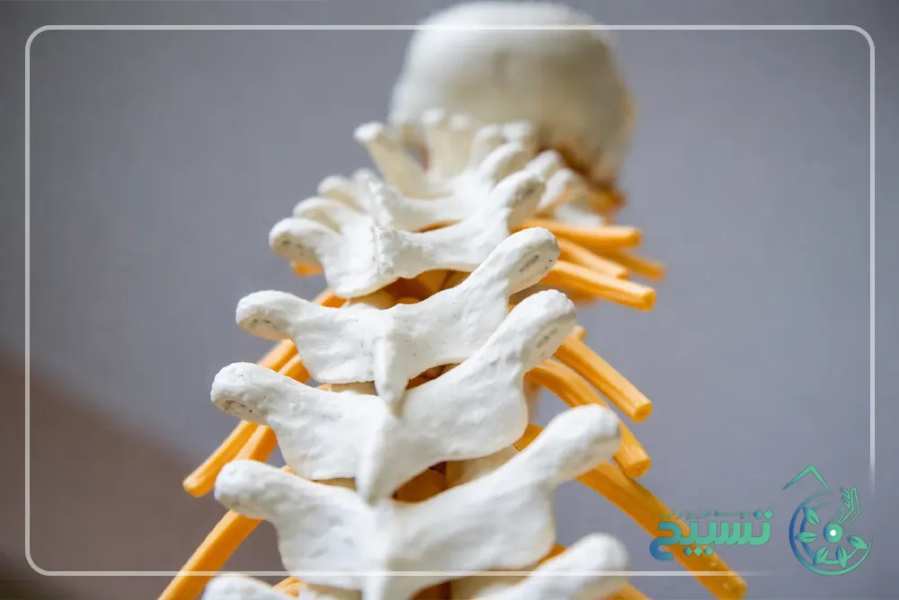 درمان فیزیوتراپی ستون فقرات
