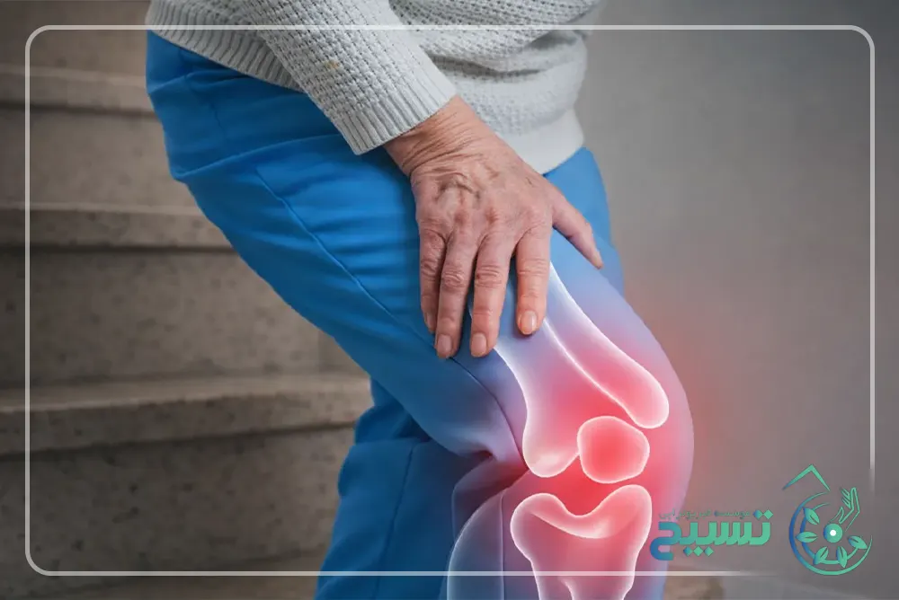 زمان مراجعه به متخصص برای آرتروز زانو