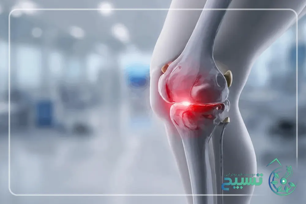 علائم التهاب تاندون کشکک زانو