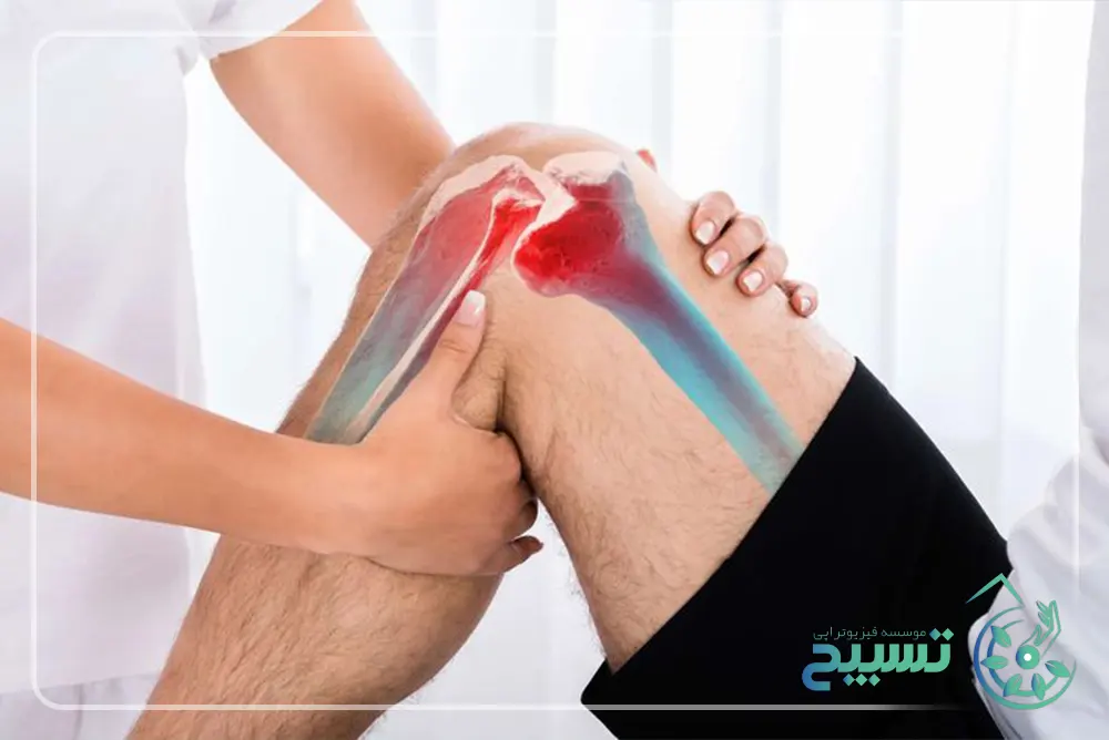 علائم پارگی رباط صلیبی