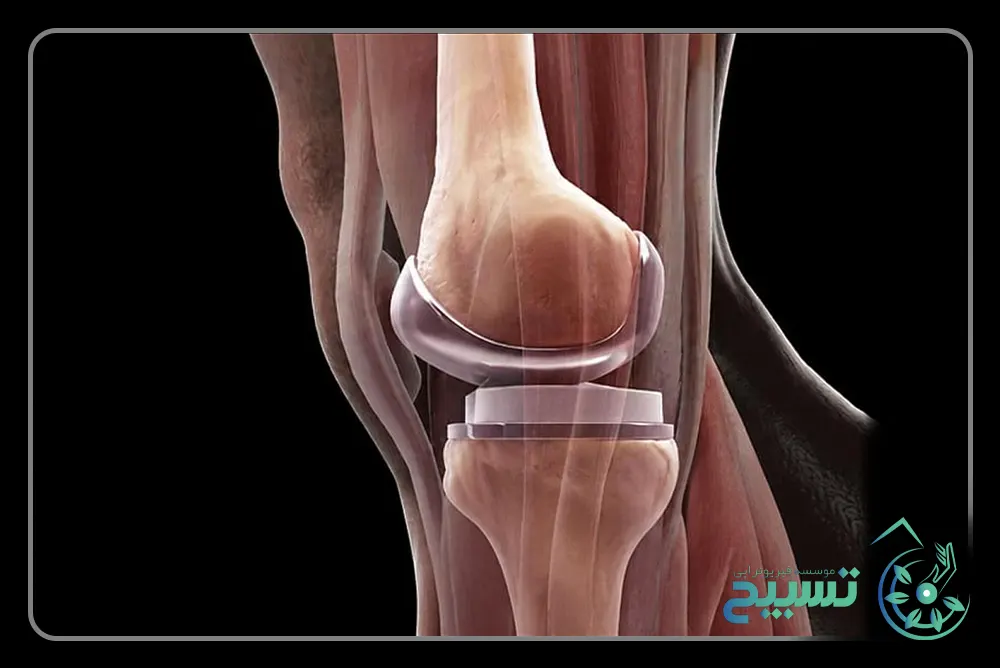عوارض احتمالی ریویژن